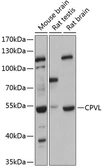 Anti-CPVL antibody used in Western Blot (WB). GTX04799