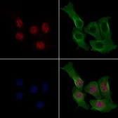 Anti-FOXM1 antibody used in Immunocytochemistry/ Immunofluorescence (ICC/IF). GTX04803