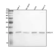 Anti-CXCL11 antibody [18C54] used in Western Blot (WB). GTX04815