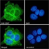 Anti-CD47 antibody used in Immunocytochemistry/ Immunofluorescence (ICC/IF). GTX04816