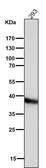 Anti-CDX2 antibody [AFA-3] used in Western Blot (WB). GTX04824