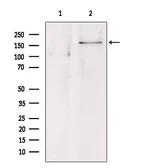 Anti-SUR1 antibody used in Western Blot (WB). GTX04854
