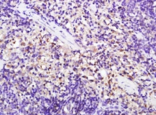 Anti-CD8 alpha antibody used in IHC (Paraffin sections) (IHC-P). GTX04862