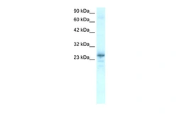 Anti-NKX2.8 antibody used in Western Blot (WB). GTX04864
