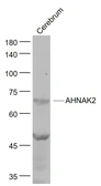 Anti-AHNAK2 antibody used in Western Blot (WB). GTX04899