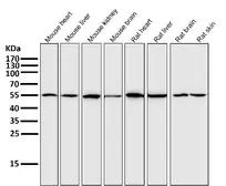 Anti-xCT / SLC7A11 antibody [ACGI-19] used in Western Blot (WB). GTX04907
