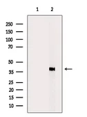 Anti-xCT / SLC7A11 antibody used in Western Blot (WB). GTX04911