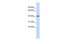 Anti-PARP11 antibody used in Western Blot (WB). GTX04915