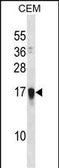 Anti-NDSP antibody used in Western Blot (WB). GTX04923