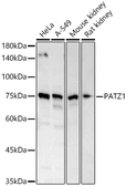 Anti-PATZ1 antibody used in Western Blot (WB). GTX04951
