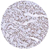 Anti-TFE3 antibody [MSVA-403R] HistoMAX&trade; used in IHC (Paraffin sections) (IHC-P). GTX04963