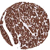 Anti-MYH7 antibody [MSVA-464M] HistoMAX&trade; used in IHC (Paraffin sections) (IHC-P). GTX04970