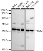 Anti-HEY2 antibody used in Western Blot (WB). GTX04982