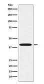 Anti-LHX3 antibody [24L36] used in Western Blot (WB). GTX04986