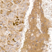 Anti-AGRP antibody used in IHC (Paraffin sections) (IHC-P). GTX04995