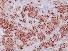 Anti-PIT1 antibody [PIT1/7262] used in IHC (Paraffin sections) (IHC-P). GTX05006
