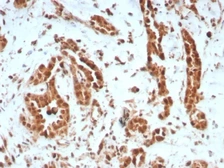 Anti-BAP1 antibody [BAP1/8959R] used in IHC (Paraffin sections) (IHC-P). GTX05007