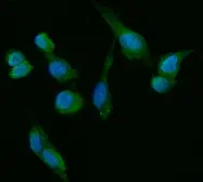 Anti-HSD3B1 antibody [3F3C/7F9C8] used in Immunocytochemistry/ Immunofluorescence (ICC/IF). GTX05017
