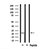 Anti-GPX4 antibody used in Western Blot (WB). GTX05018
