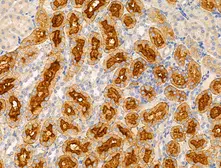 Anti-SLC25A6 antibody used in IHC (Paraffin sections) (IHC-P). GTX05020