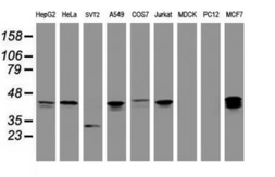 Anti-PRR11 antibody [OTI1A4] used in Western Blot (WB). GTX05022