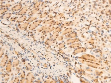 Anti-IKB alpha (phospho Ser32/Ser36) antibody used in IHC (Paraffin sections) (IHC-P). GTX05029