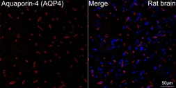 Anti-Aquaporin 4 antibody [ARC54345] used in IHC (Paraffin sections) (IHC-P). GTX05045
