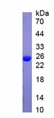 Human CRP protein. GTX05053-pro