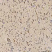 Anti-SLC25A10 antibody used in IHC (Paraffin sections) (IHC-P). GTX05059