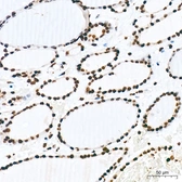Anti-Pan phosphoserine/threonine antibody [ARC64485] used in IHC (Paraffin sections) (IHC-P). GTX05060