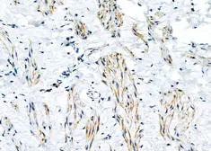Anti-KDELR2 antibody used in IHC (Paraffin sections) (IHC-P). GTX05062