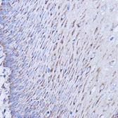 Anti-MT-ND1 antibody used in IHC (Paraffin sections) (IHC-P). GTX05066