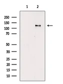 Anti-FAK (phospho Tyr861) antibody used in Western Blot (WB). GTX05090