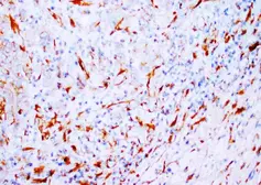 Anti-beta Tubulin antibody [TUB 2.1] used in IHC (Paraffin sections) (IHC-P). GTX05098