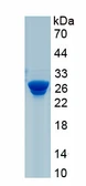 Human Calcium binding protein p22 protein, His tag. GTX05102-pro