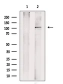 Anti-NLRP3 antibody used in Western Blot (WB). GTX05106