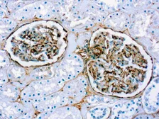 Anti-Fibronectin antibody (ready-to-use) used in IHC (Paraffin sections) (IHC-P). GTX05128