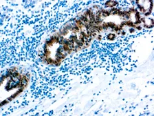 Anti-Hsp70 antibody [W27] (ready-to-use) used in IHC (Paraffin sections) (IHC-P). GTX05136