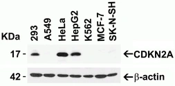 Anti-CDKN2A / p16INK4a antibody used in Western Blot (WB). GTX05147