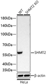 Anti-SHMT2 antibody [ARC78312] used in Western Blot (WB). GTX05153