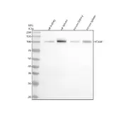 Anti-VCAM1 / CD106 antibody [DCA-22] used in Western Blot (WB). GTX05158