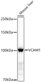 Anti-VCAM1 / CD106 antibody used in Western Blot (WB). GTX05159