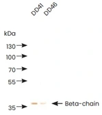 Anti-D-Dimer antibody [DD41] used in  (). GTX05174