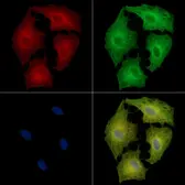 Anti-Defensin alpha 5 antibody used in Immunocytochemistry/ Immunofluorescence (ICC/IF). GTX05178