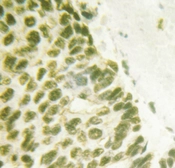 Anti-FANCD2 (phospho Ser222) antibody used in IHC (Paraffin sections) (IHC-P). GTX05195