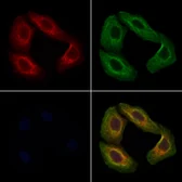 Anti-POMGNT1 antibody used in Immunocytochemistry/ Immunofluorescence (ICC/IF). GTX05196
