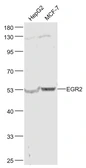Anti-EGR2 antibody used in Western Blot (WB). GTX05198