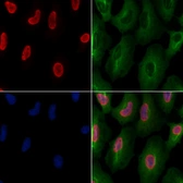 Anti-DDX5 antibody used in Immunocytochemistry/ Immunofluorescence (ICC/IF). GTX05200