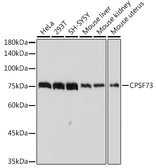 Anti-CPSF73 antibody [ARC2567] used in Western Blot (WB). GTX05201