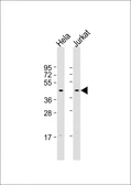Anti-FBXO32 antibody used in Western Blot (WB). GTX05208